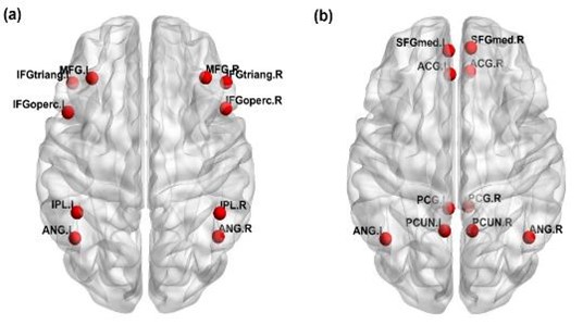 FIGURE 1: Brain areas of the (a) frontoparietal network and (b) default-mode network based on Automated Anatomical Labelling. MFG: Middle frontal gyrus; IFGoperc: Inferior frontal gyrus opercularis; IFGtriang: Inferior Frontal gyrus triangularis; IPL: Inferior parietal lobe; ANG: Angular gyrus; SFGmed: Superior medial frontal gyrus; ACG: Anterior cingulate gyrus; PCG: Posterior cingulate gyrus; PCUN: Precuneus. For variance analysis of functional connectivity, ‘.L’ and ‘.R’ represented the left and right he