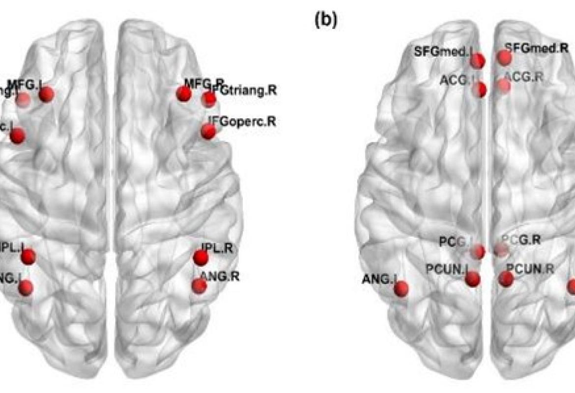 FIGURE 1: Brain areas of the (a) frontoparietal network and (b) default-mode network based on Automated Anatomical Labelling. MFG: Middle frontal gyrus; IFGoperc: Inferior frontal gyrus opercularis; IFGtriang: Inferior Frontal gyrus triangularis; IPL: Inferior parietal lobe; ANG: Angular gyrus; SFGmed: Superior medial frontal gyrus; ACG: Anterior cingulate gyrus; PCG: Posterior cingulate gyrus; PCUN: Precuneus. For variance analysis of functional connectivity, ‘.L’ and ‘.R’ represented the left and right he