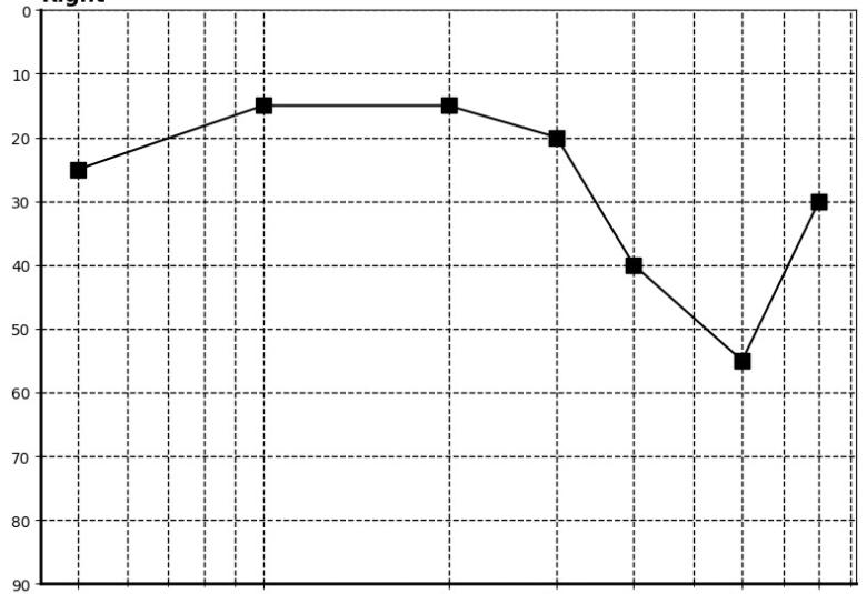 The repeated PTA result with masking (right ear)
