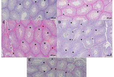 Haematoxylin and Eosin (H&E) staining of the testis sections for each experimental group. Figures were recorded under 10x magnification. (A) Control; (B) EBN; (C) Wi-Fi 1; (D) Wi-Fi 2; (E) EBNW group. S represented spermatozoa; GC represented germinal epithelium; ■ represented a normal arrangement of seminiferous tubule; ▲represented detachment/free spaces of the cells from the basement membrane; ● showed pink edematous lesion (shading different in Figure 1B to 1E)