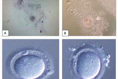 This showed oocytes denudation process. (A) Cumulus Oocytes Complex prepared for mechanical denudation without enzyme; (B) Cumulus Oocytes Complex enzymolysed in hyaluronidase; (C) “Naked” oocytes following enzymolysed in hyaluronidase – clean edge; (D) “Naked” oocytes following mechanical denudation – minimal cumulus cell at the edge